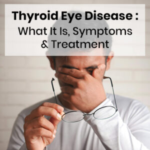 Thyroid Eye Disease