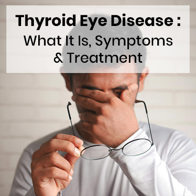 Thyroid Eye Disease: What It Is, Symptoms & Treatment