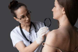 Skin Cancer Screening