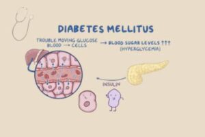 Endocrine System Related to Diabetes