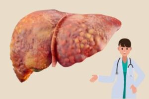 Fatty Liver Disease