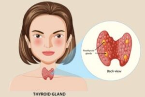 thyroid problems