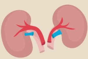 kidney disease in australia