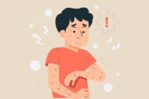 itchy skin