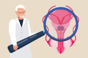 Facts About Vasectomies
