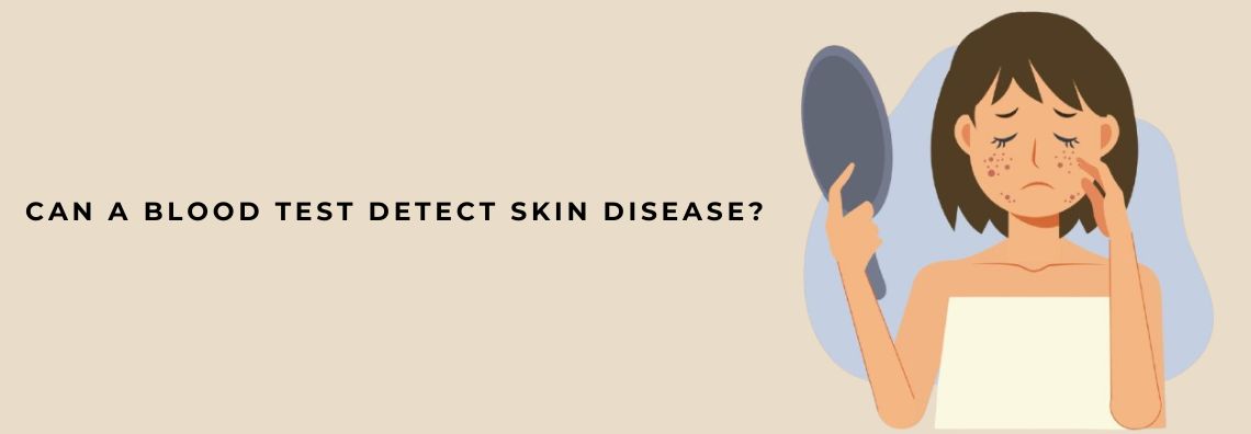 detect skin disease