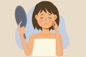 detect skin disease