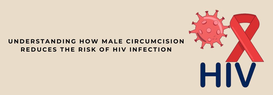 HIV infection