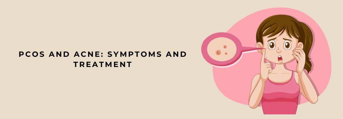 PCOS and Acne